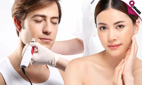 Microneedling Session for Ladies & Men!